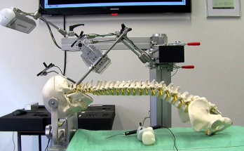 Advancements in Spine Surgery Robots Driving Precision and Efficiency